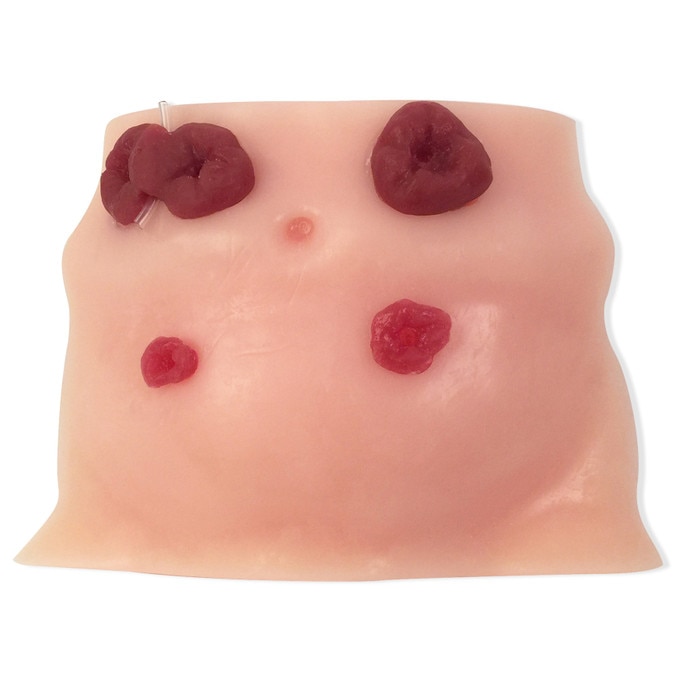 Ostomy Care Model, Beige, for health education and training, brown lifelike torso model with four stomas, Health Edco 26130