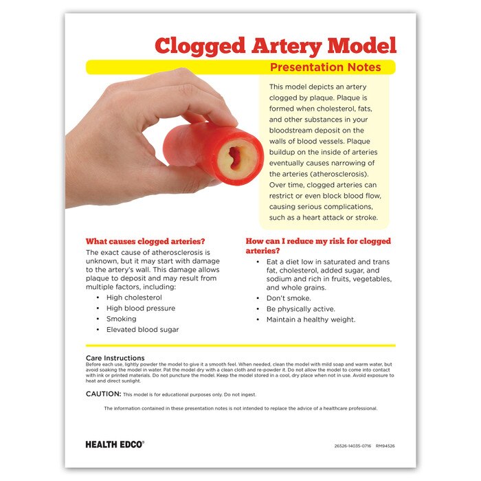 clogged artery model, English and Spanish presentation notes, enlarged view, simulated plaque build-up, synthetic tissue, squeezable, Health Edco, 26526