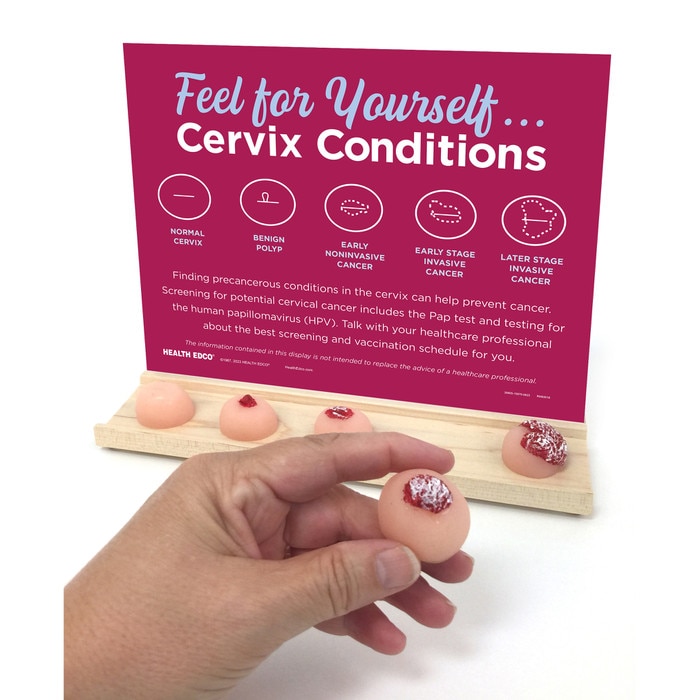 Feel for Yourself: Cervix Conditions Display for health education by Health Edco to promote cervical cancer screening, 26805