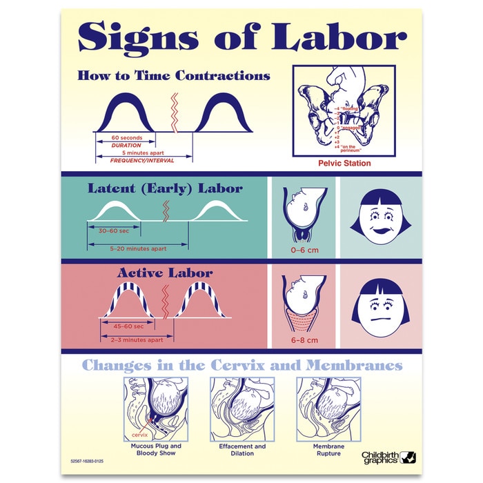 Signs of Labor Tear Pad by Childbirth Graphics for childbirth education and teaching about labor and cervical changes, 52567