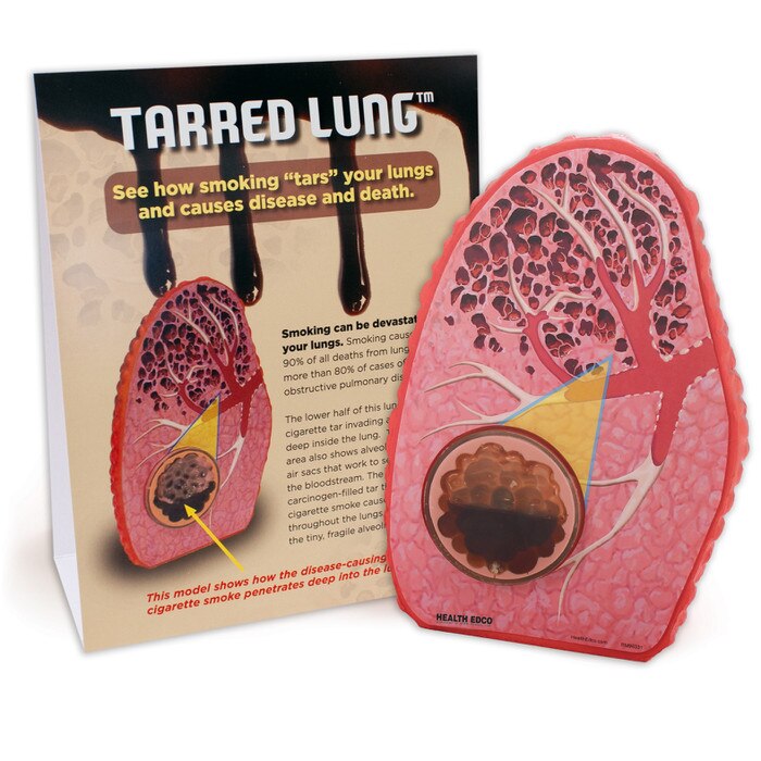 Tarred Lung Model, health education lung model to deter smoking with educational tent card, Health Edco teaching tools, 79234