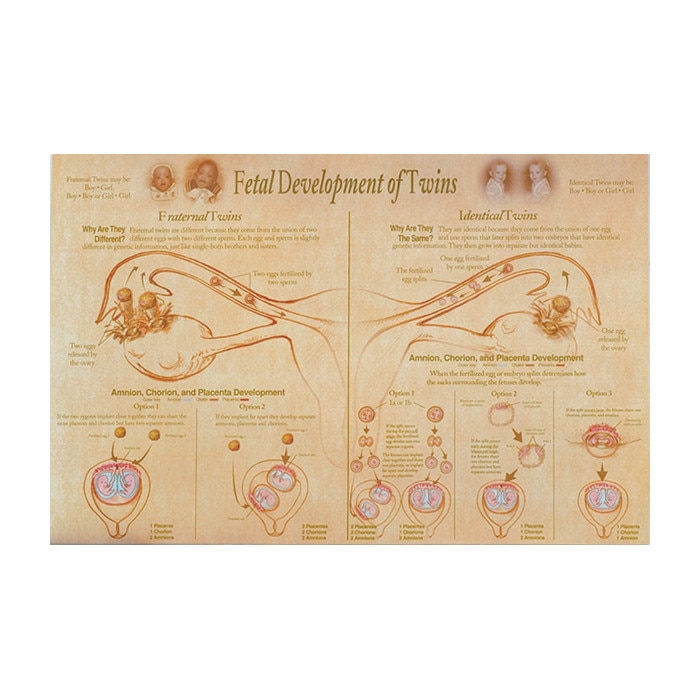 Post Twins Chart, Fetal Development of Twins illustrated fraternal & identical development, Childbifrth Graphics, 89643