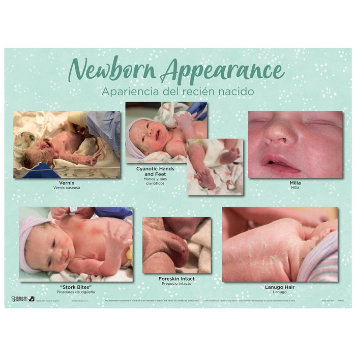 Newborn Chart Set (3), Newborn Appearance Chart with parenting education photos of newborn traits, Childbirth Graphics, 90160